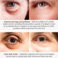 Eye contour cream: lifting effect in 2 minutes 